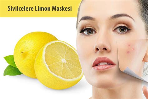 Limon Maskesi ile Cilt Beyazlatma